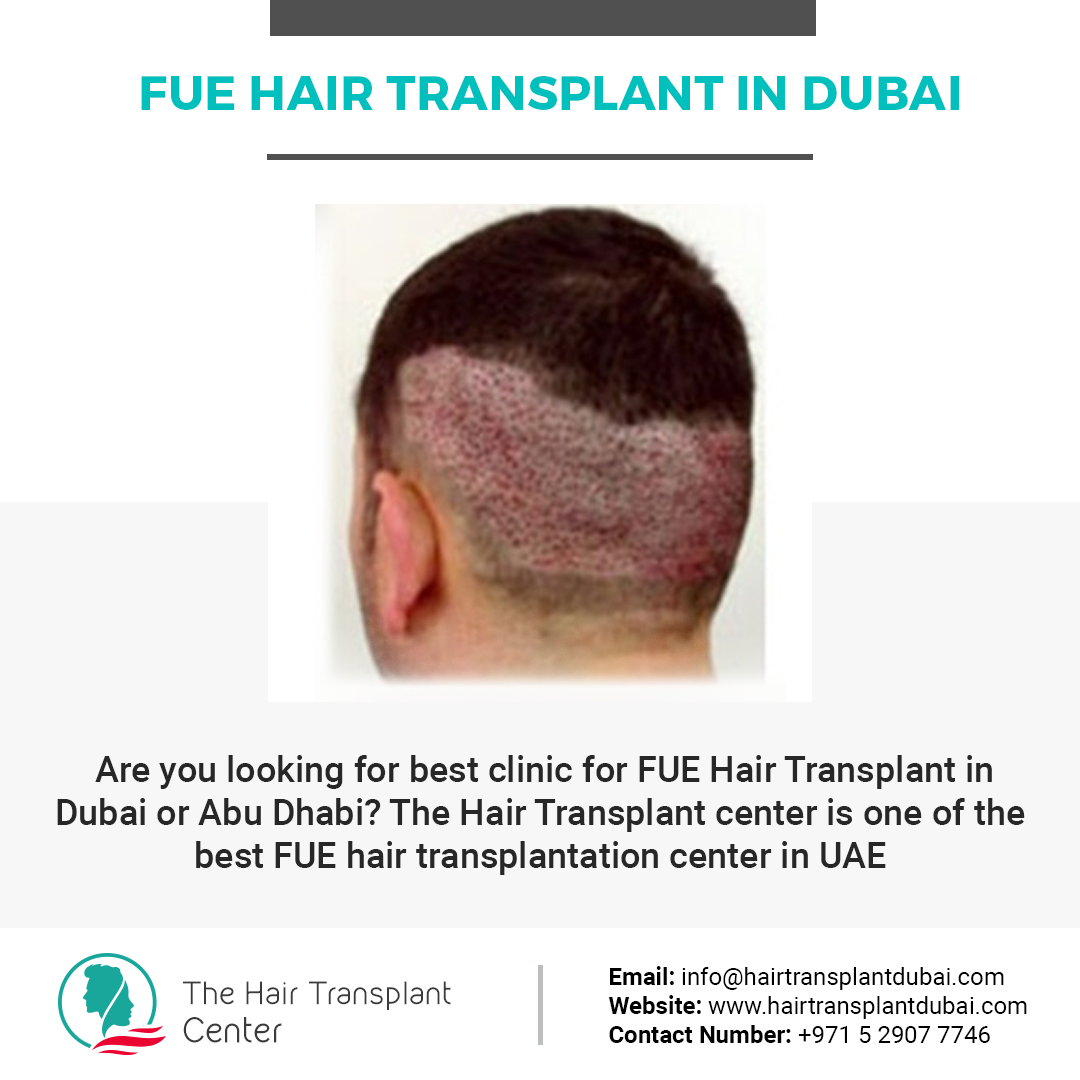 Fue Hair Transplant In Dubai, زرع الشعر Fue في دبي (UAE++)